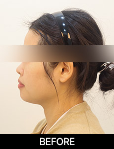 before 이미지