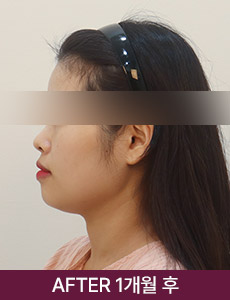 after 이미지