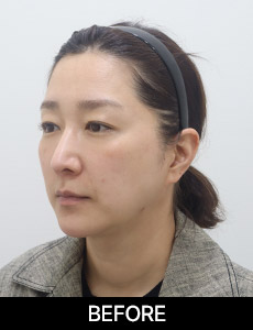 before 이미지
