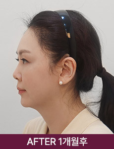 after 이미지