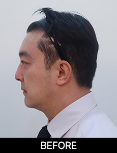 before 이미지