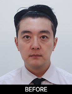 before 이미지