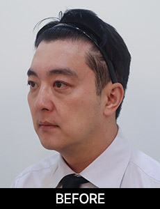 before 이미지