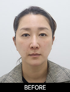before 이미지