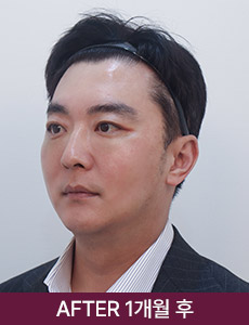 after 이미지