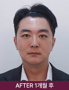 after 이미지