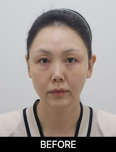 before 이미지
