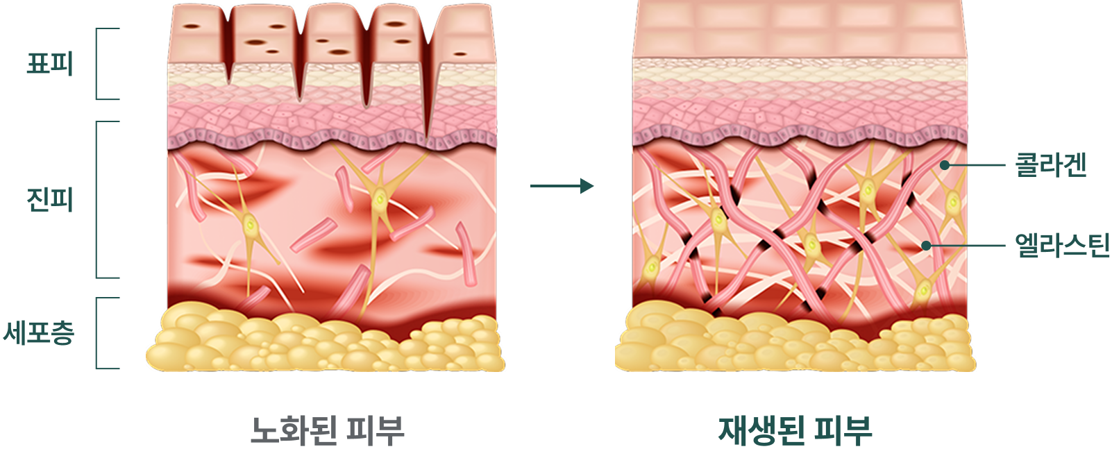 셀트라콜